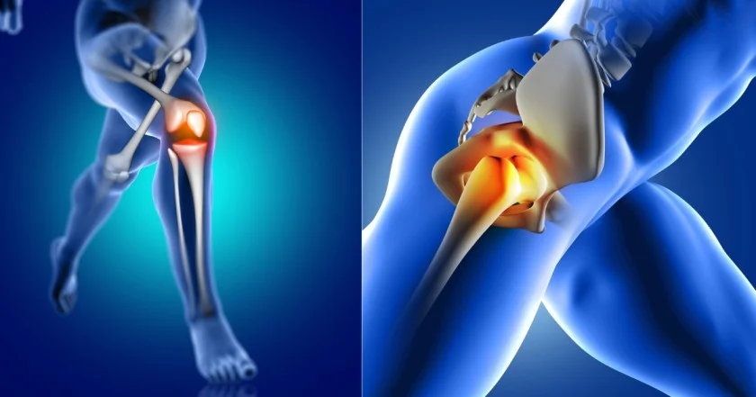 Artificial Joints Do Not Last Long